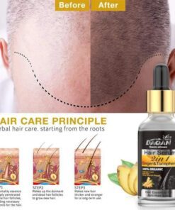 Anti Hair Loss Serum 2 In 1 Natural Hair Fall Serum Ginger And Tocopherol Hair Growth Essence Oil Hair Care Serum