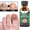 Foot Nail Fungus Removal Gel