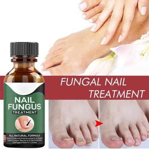 Foot Nail Fungus Removal Gel - Image 5